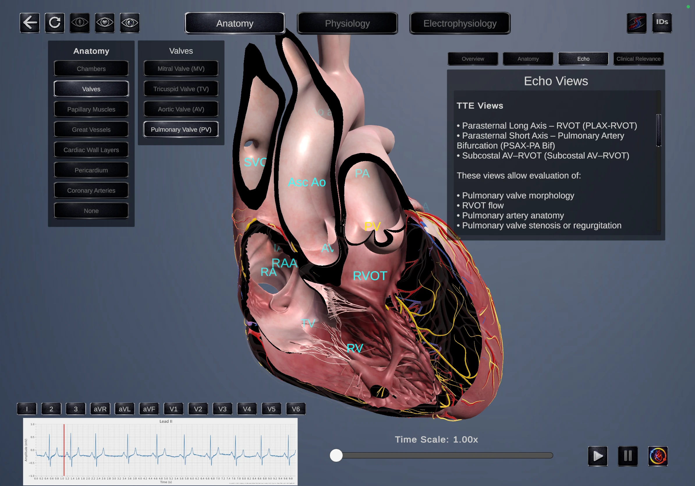 Echo Simulator anatomy module
