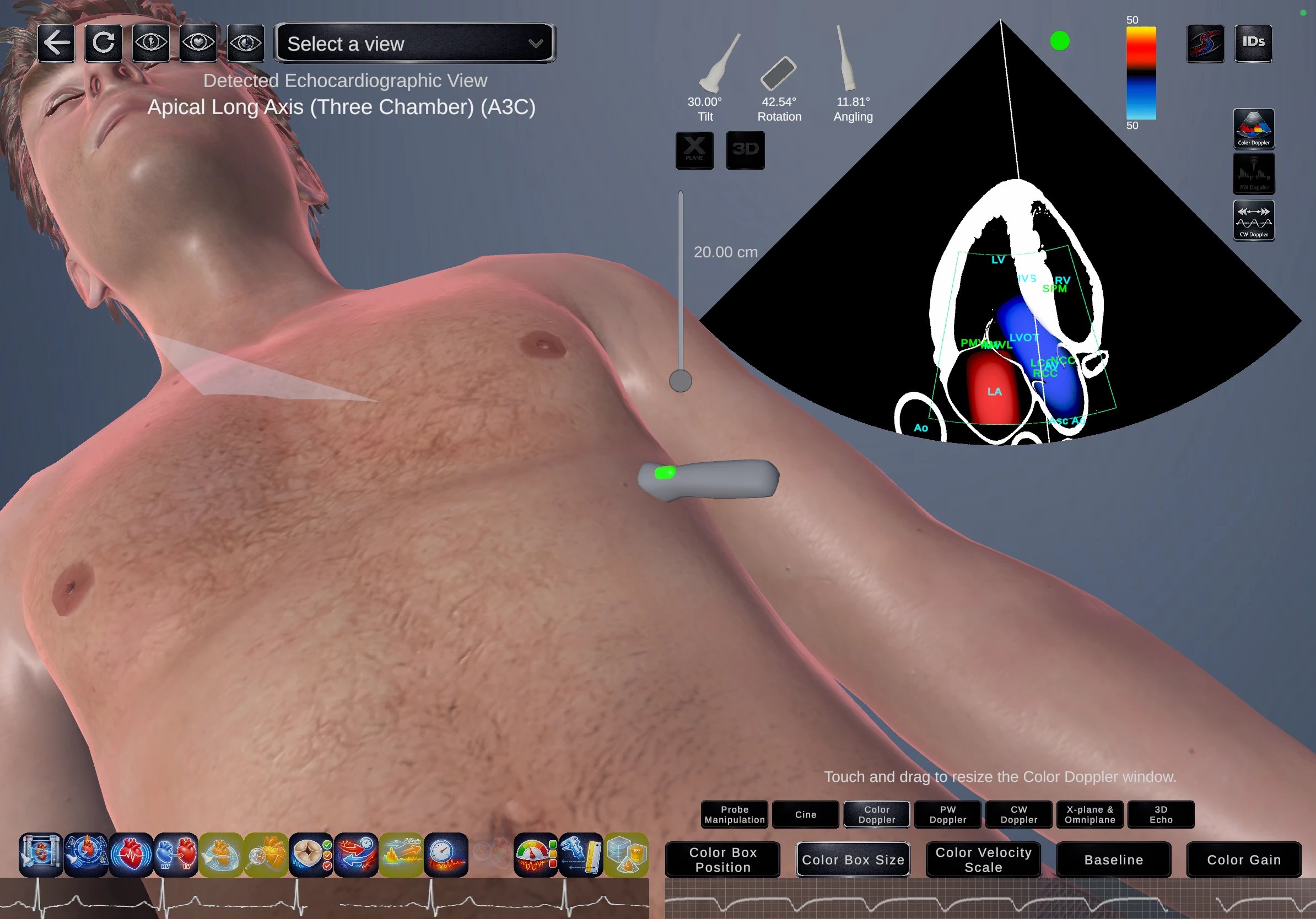 Echo Simulator TTE module